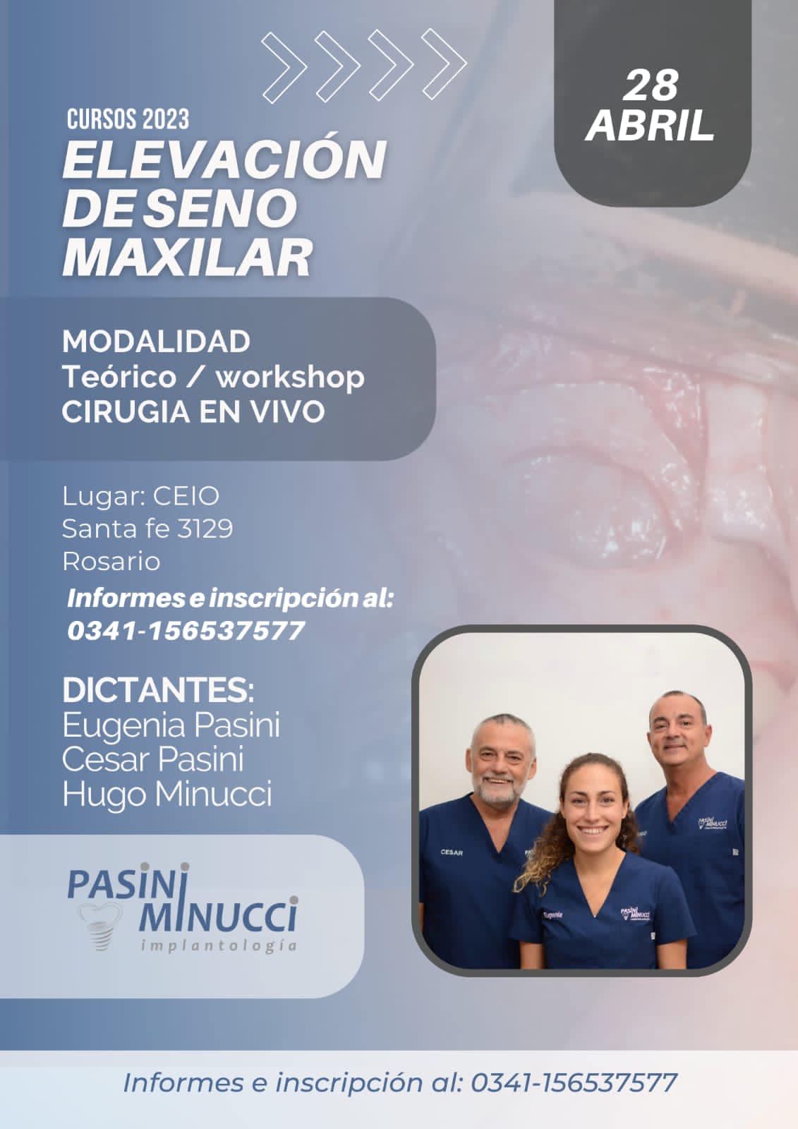 Curso Elevación de Seno Maxilar